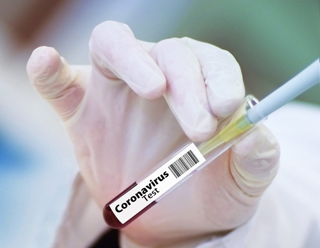 коронавирус, Covid-19, тест, лабораторное исследование, анализ крови
