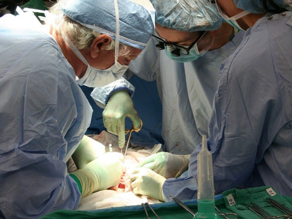 операция, хирургия, трансплантация