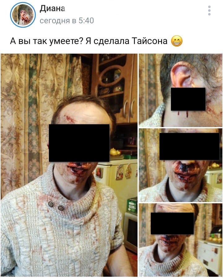 жительница Гагарина откусила мочку мужу (удалённый пост vk.com diananilsen21)