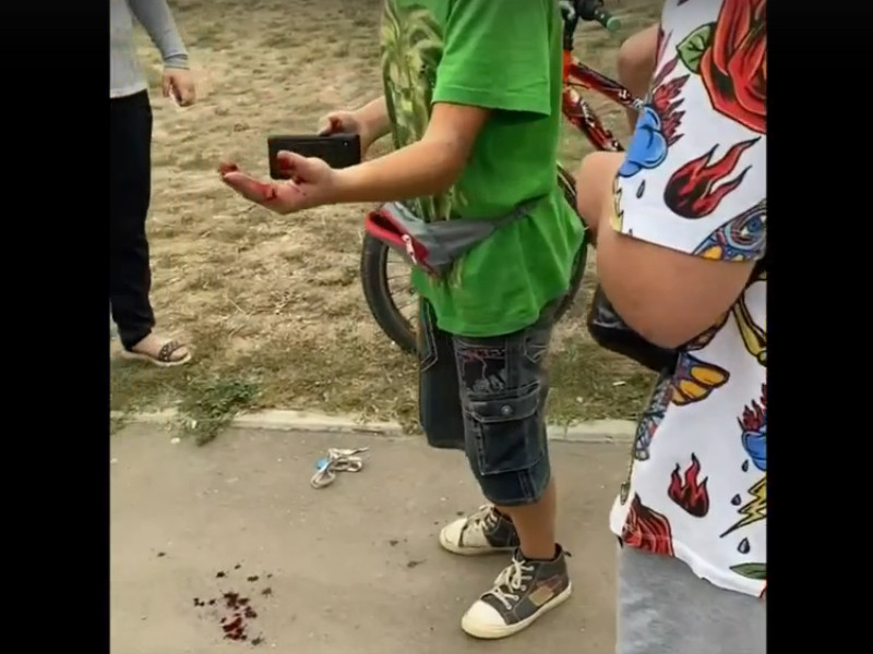 мальчик в Ярцеве пострадал от взрыва петарды